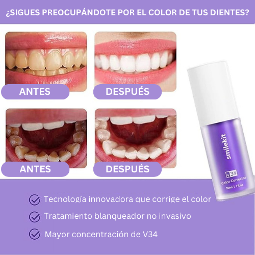 Blanqueador SmileKit Dental™ - TRENDFINDER® (2024)